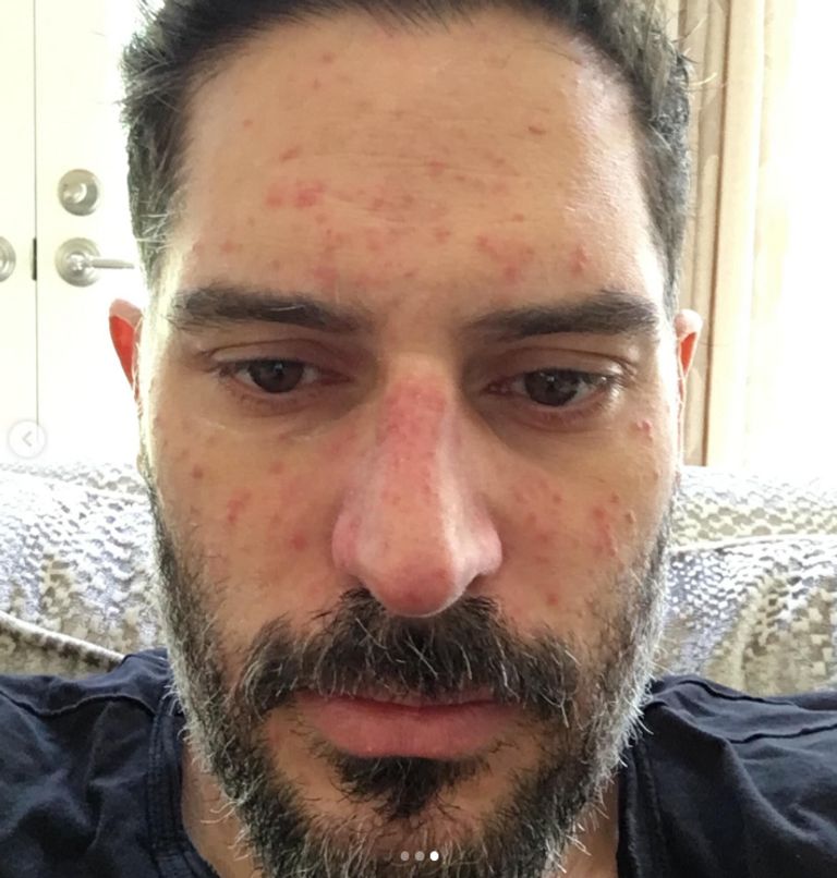 Joe Manganiello Shares Hospital Bed Photo Revealing What His Body Looked Like at His Lowest Point