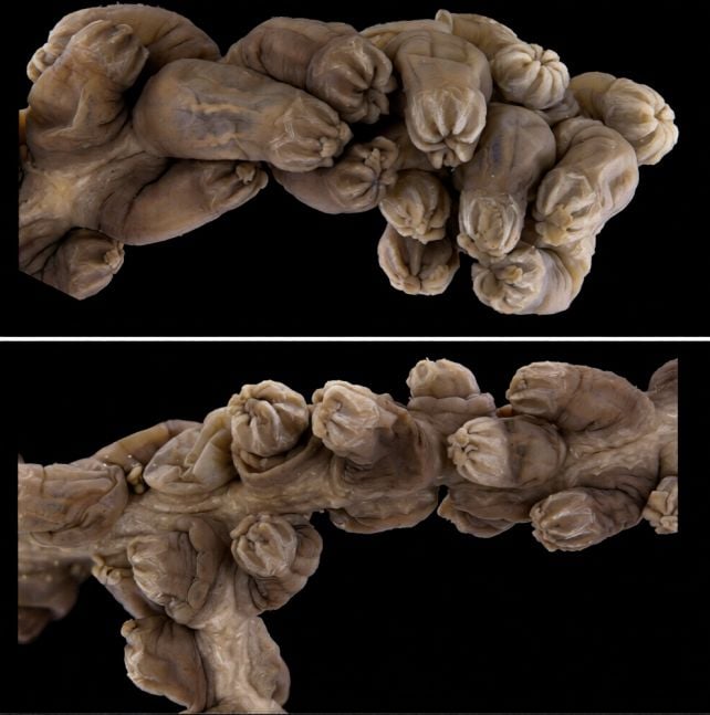 Mysterious 'Golden Tree' Coral Is So Weird, Scientists Had to Create a New Family on The Tree of Life