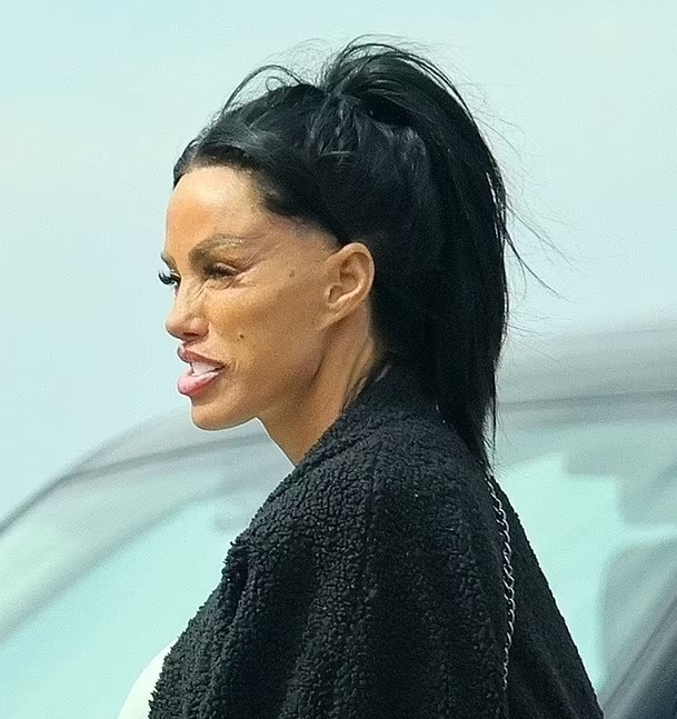 The Former Glamour Model Looks Unrecognizable After Multiple Interventions: Can You Guess The Star?