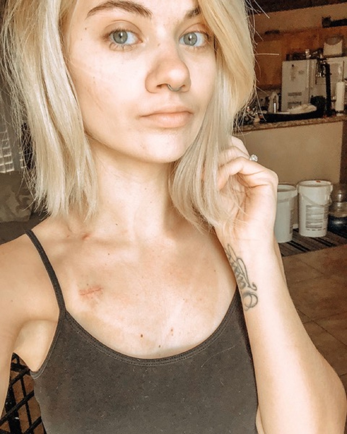 ‘You’re really lucky you came in today, because something is definitely wrong.’: Woman strives to overcome unexpected Hodgkin’s Lymphoma diagnosis